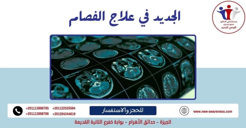 الجديد في علاج الفصام 2021