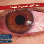 كيف أعرف المدمن من عيونه؟