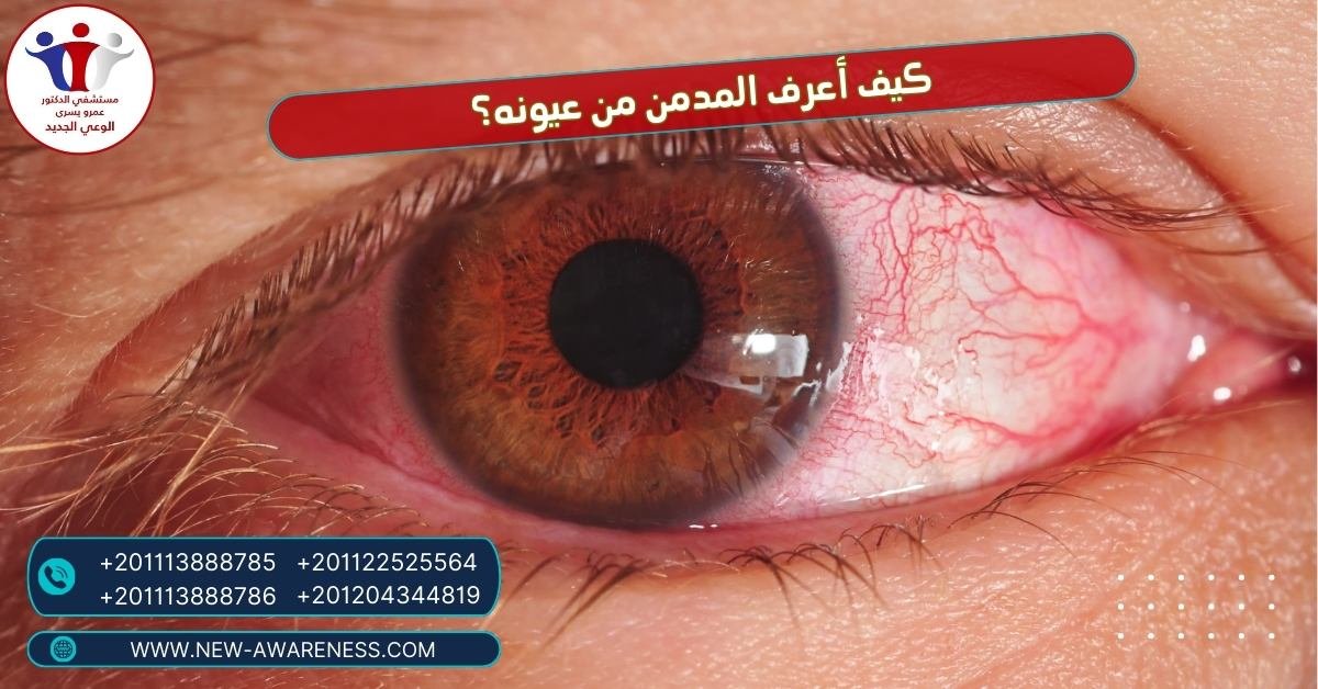 كيف أعرف المدمن من عيونه؟