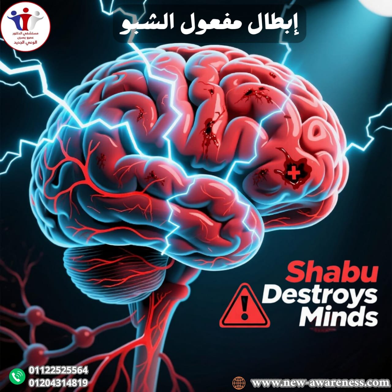 إبطال مفعول الشبو
